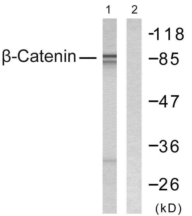 CTNNB1 / Beta Catenin Antibody (p33/37)
