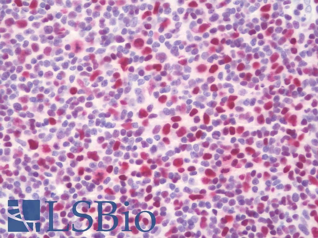 IHC-plus™ RUNX3 Antibody (clone 2B3)