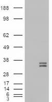 NTF3 / Neurotrophin 3 Antibody (clone OTI5C7)