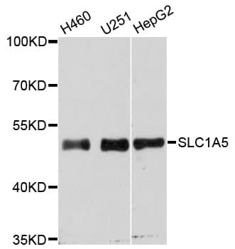 Polyclonal Rabbit anti-Human SLC1A5 / ASCT2 Antibody (WB)