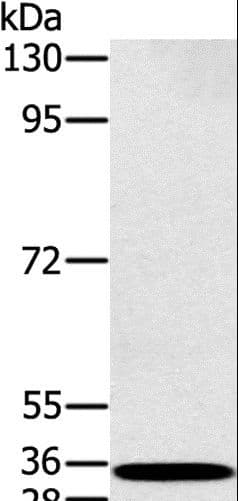 RAB27A / RAB27 Antibody