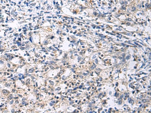 SLC30A3 / ZNT3 Antibody