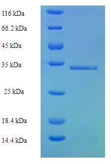 Human FAT10 / UBD Protein (Recombinant His-SUMO)