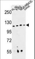 RPGRIP1 Antibody (aa530-557)