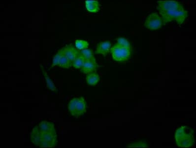 Polyclonal Rabbit anti-Human HEPACAM Antibody (IF, WB)