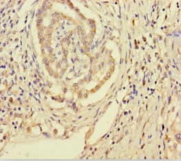SMPD3 / NSMASE2 Antibody