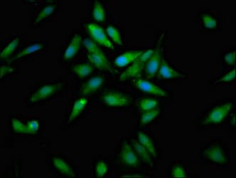 ACO1 / Aconitase Antibody