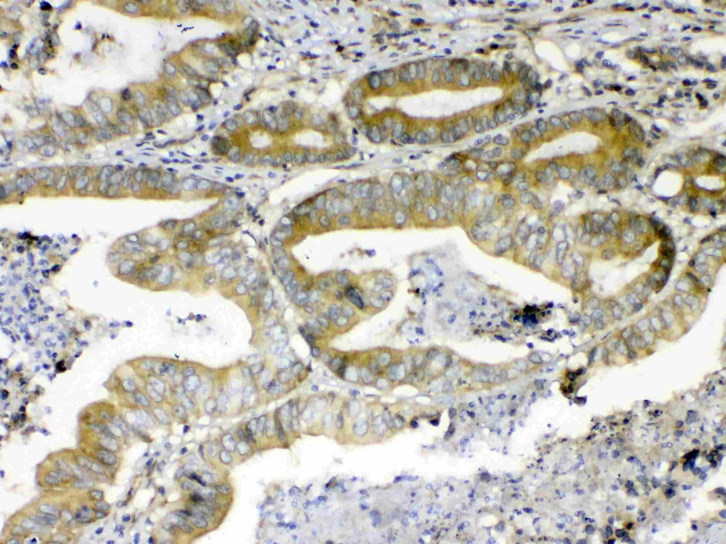 ERBB4 / HER4 Antibody
