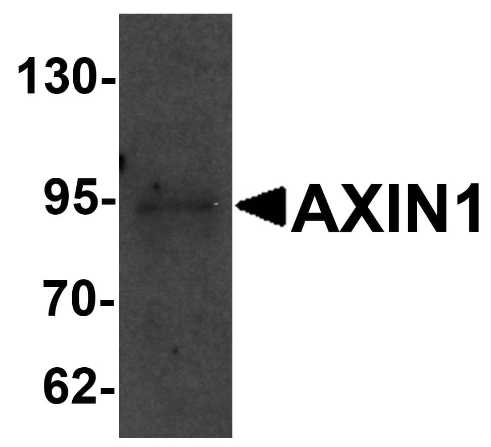IHC-plus™ AXIN1 / Axin-1 Antibody