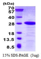 Human DBNDD2 Protein (Recombinant His)