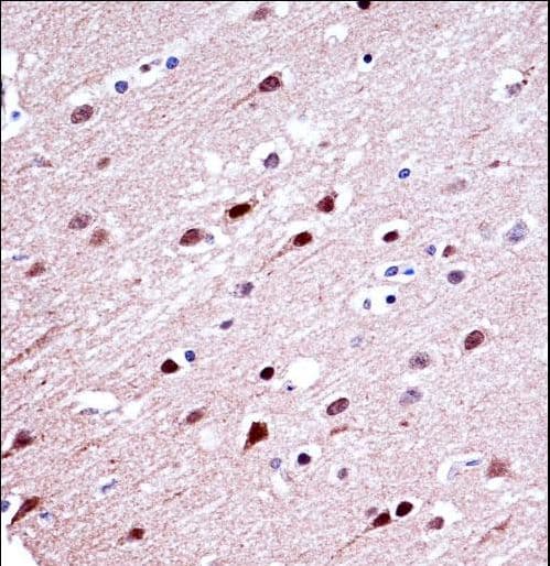 Polyclonal Rabbit anti-Human KCND2 / Kv4.2 Antibody (aa123-151, IHC, WB)