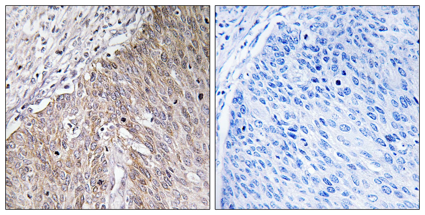 Polyclonal Rabbit anti-Human APOL2 / Apolipoprotein L 2 Antibody (aa191-240, IHC, IF, WB)