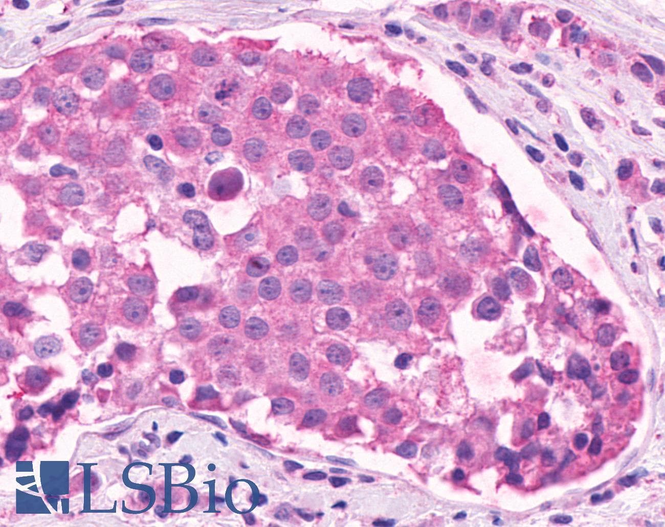 PathPlus™ OR2A4 Antibody (Cytoplasmic Domain)