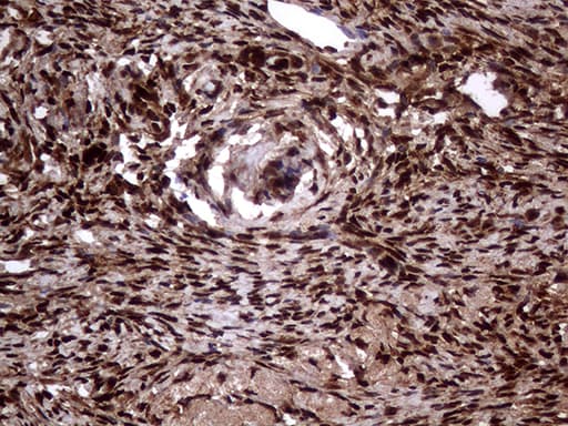 Monoclonal Mouse anti-Human TALDO1 / Transaldolase 1 Antibody (clone OTI1A5, IHC, WB)
