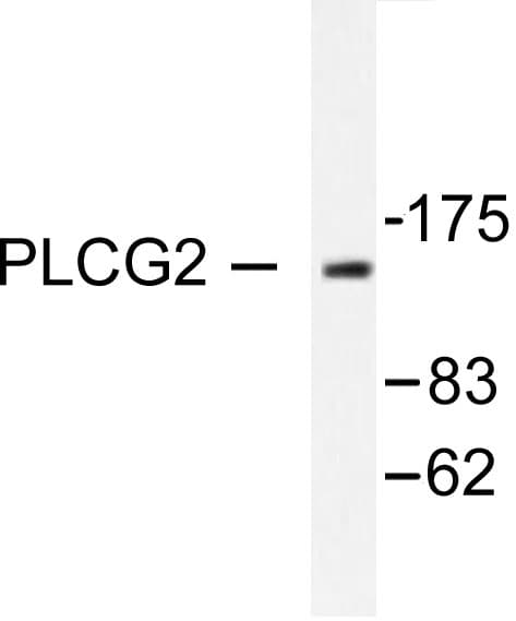 PLCG2 / PLC Gamma 2 Antibody (Arg747)