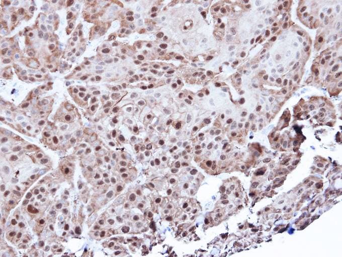 ANXA1 / Annexin A1 Antibody (aa1-228)