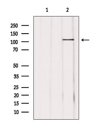 USP11 Antibody