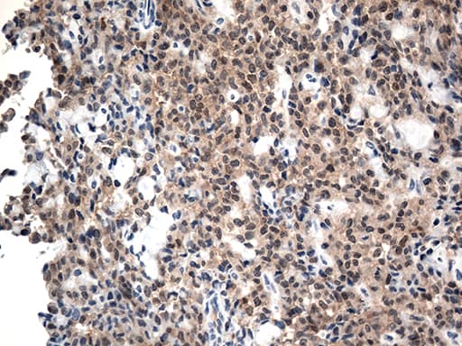 CSTB / Cystatin B / Stefin B Antibody (aa1-98, clone OTI3D5)