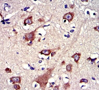 GSN / Gelsolin Antibody