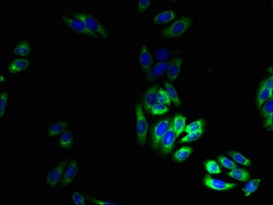 TRPM2 Antibody (aa60-119)