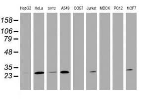 BCL10 / BCL-10 Antibody (clone OTI3C4)
