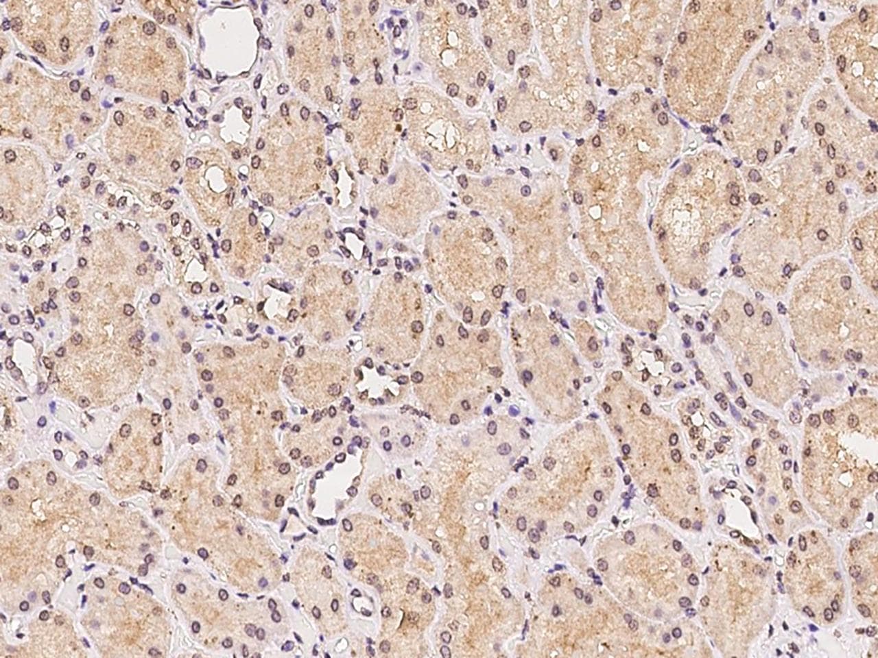 Polyclonal Rabbit anti-Human SIRT3 / Sirtuin 3 Antibody (IHC)