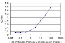 Monoclonal Mouse anti-Human SLC2A4 / GLUT-4 Antibody (clone 1F12, WB)