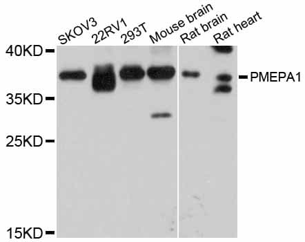 Polyclonal Rabbit anti-Human TMEPAI / PMEPA1 Antibody (IF, WB)