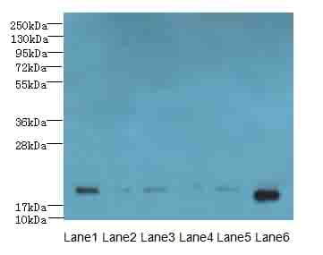 SPATA19 Antibody