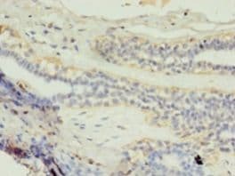 GK2 / Glycerol Kinase 2 Antibody (aa2-553)