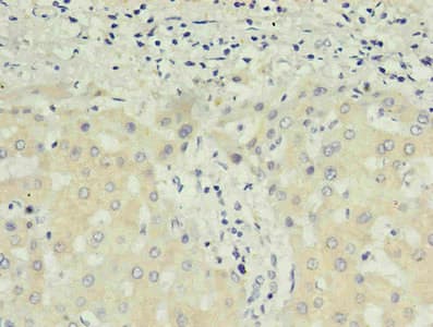 Monoclonal Mouse anti-Human Alpha-Fetoprotein Antibody (clone 4G2D2, IHC)