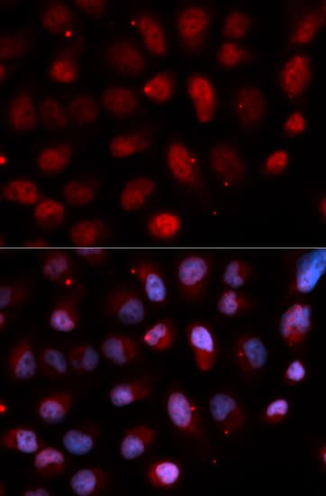 PEA3 / ETV4 Antibody