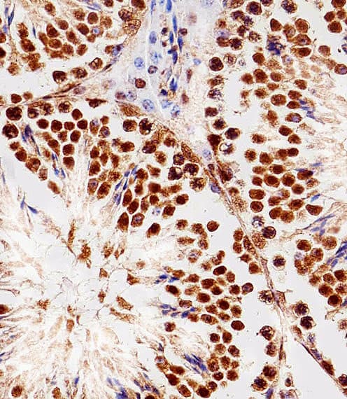Polyclonal Rabbit anti-Human RBX1 / ROC1 Antibody (aa74-108, IHC, IF, WB)