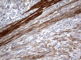 Hamartin / TSC1 Antibody (clone OTI3A2)