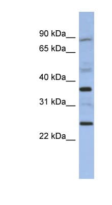 Polyclonal Rabbit anti-Human MAGEB3 Antibody (N-Terminus, WB)