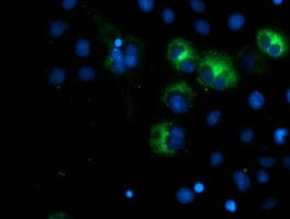 Paraplegin / SPG7 Antibody (clone OTI5H7)
