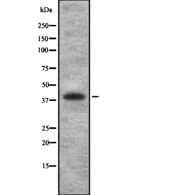 TGFB4 / LEFTY2 Antibody