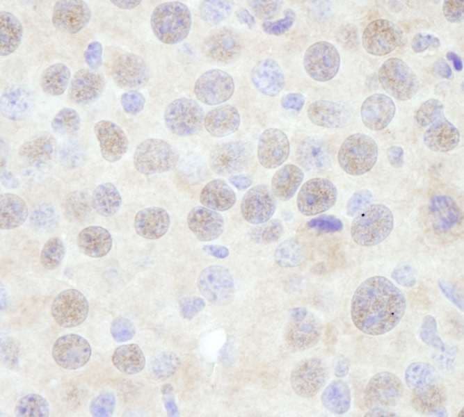 Polyclonal Rabbit anti-Human CHD3 Antibody (aa1950-2000, IHC)