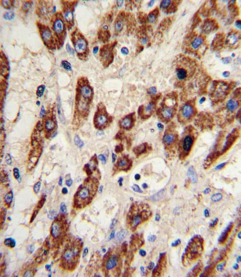 MMP3 Antibody (aa298-327)