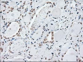 GFAP Antibody (clone OTI4D11)