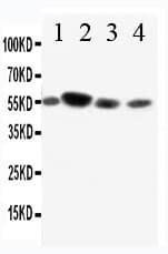 FCAR / CD89 Antibody (aa84-101)