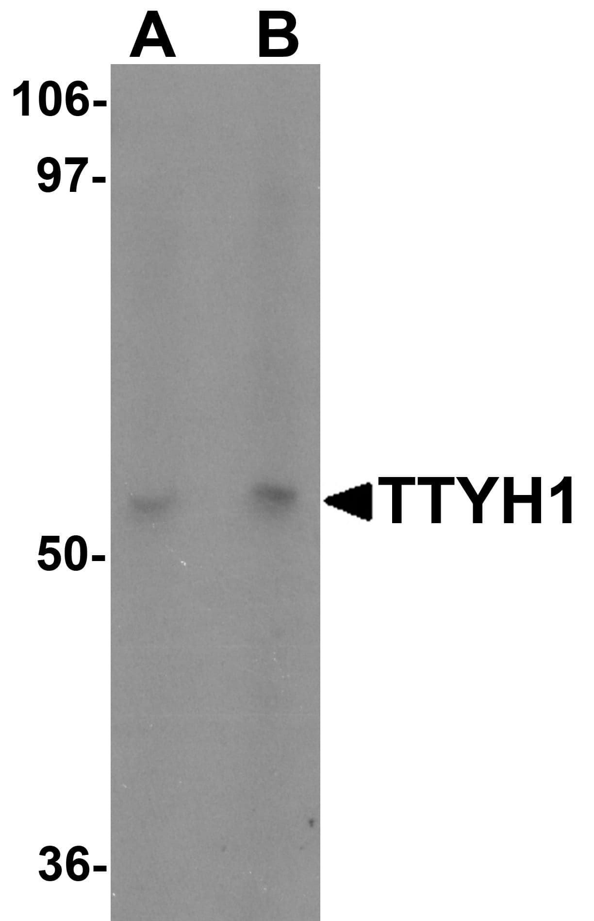Polyclonal Rabbit anti-Human HTTY1 / TTYH1 Antibody (WB)