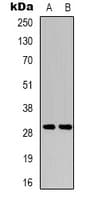 RIMS4 Antibody (Internal)