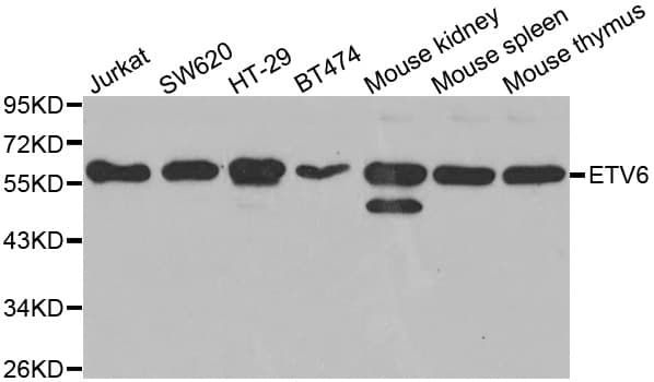 ETV6 / TEL Antibody