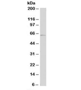 Monoclonal Mouse anti-Human Tyrosinase Antibody (clone T311, Azide-free,BSA-free, IHC, IF, WB)