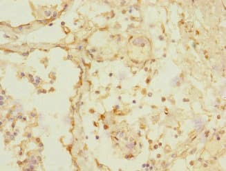 Polyclonal Rabbit anti-Human TRHDE Antibody (IHC)