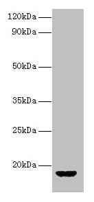 AVP / ADH / Vasopressin Antibody
