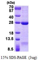 Human DNAL1 Protein (Recombinant His)