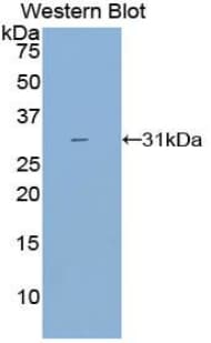 CYP21A2 Antibody (aa37-264)