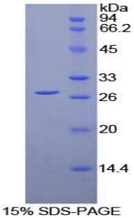 Human LILRA2 / CD85h / ILT1 Protein (Recombinant His-T7)